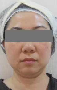 Before Arbeaute